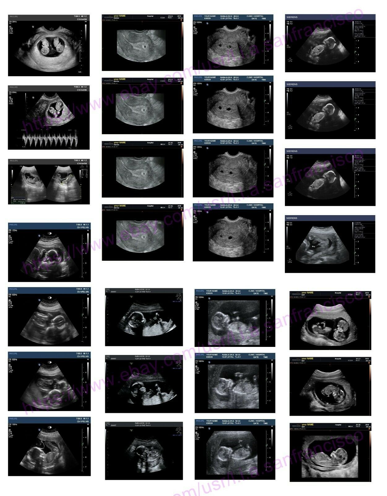 CUSTOM PRANK ULTRASOUND SONOGRAM PREGNANCY STRIP Personalized Best Gag Fun